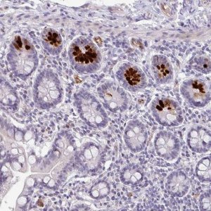 Anti-SIDT2 antibody produced in rabbit 