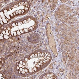 Anti-SIK1 antibody produced in rabbit 