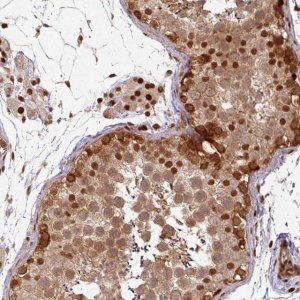 Anti-SIK3 antibody produced in rabbit 