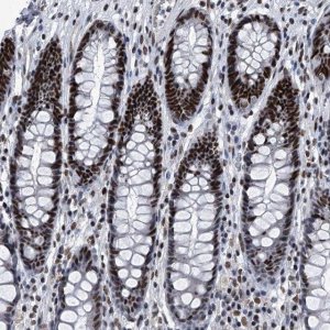 Anti-SIM2 antibody produced in rabbit 