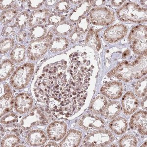 Anti-SIPA1L3 antibody produced in rabbit 