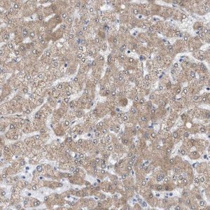 Anti-SIRT5 antibody produced in rabbit 