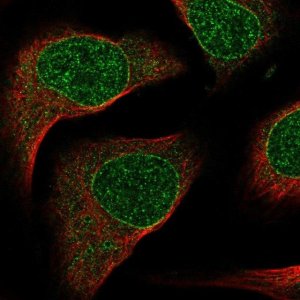 Anti-SIX2 antibody produced in rabbit 