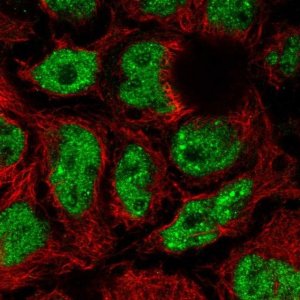 Anti-SKI antibody produced in rabbit 