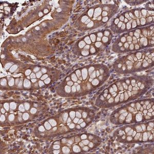 Anti-SKIDA1 antibody produced in rabbit 