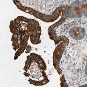 Anti-SKIL antibody produced in rabbit 
