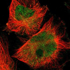Anti-SKIL antibody produced in rabbit 