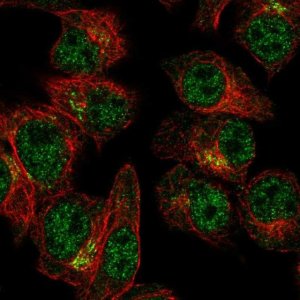 Anti-SLA2 antibody produced in rabbit 