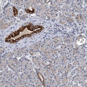 Anti-SLC11A2 antibody produced in rabbit 