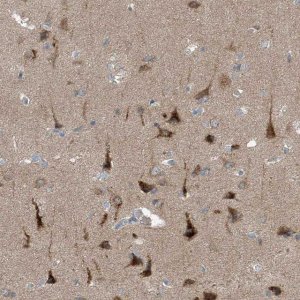Anti-SLC12A6 antibody produced in rabbit 