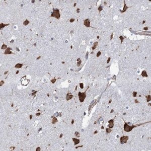 Anti-SLC12A7 antibody produced in rabbit 