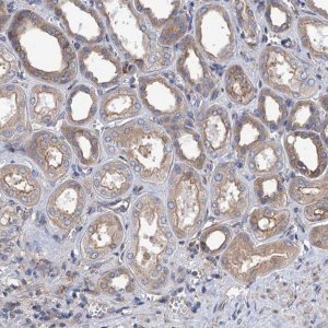 Anti-SLC12A7 antibody produced in rabbit 
