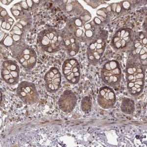 Anti-SLC12A9 antibody produced in rabbit 