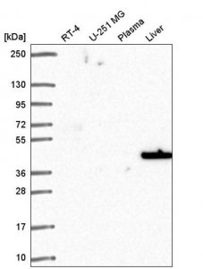Anti-SLC14A1 antibody produced in rabbit HPA058353-100UL