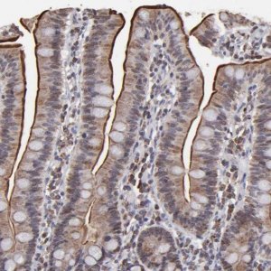 Anti-SLC15A1 antibody produced in rabbit 