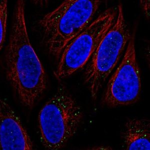 Anti-SLC15A3 antibody produced in rabbit 