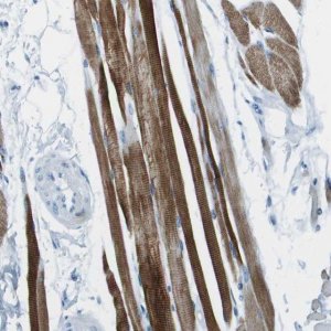 Anti-SLC16A10 antibody produced in rabbit 