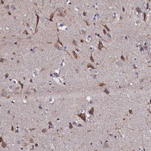 Anti-SLC16A14 antibody produced in rabbit 
