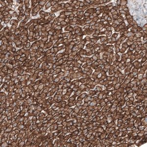 Anti-SLC16A2 antibody produced in rabbit 