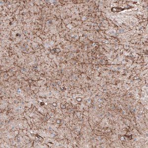 Anti-SLC16A2 antibody produced in rabbit 