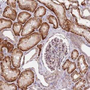 Anti-SLC16A4 antibody produced in rabbit 