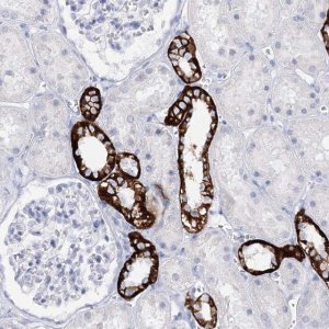 Anti-SLC17A2 antibody produced in rabbit 