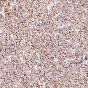 Anti-SLC17A4 antibody produced in rabbit 