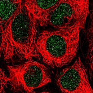 Anti-SLC17A9 antibody produced in rabbit 