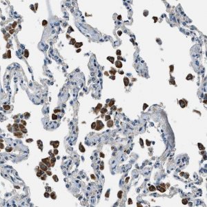 Anti-SLC19A2 antibody produced in rabbit 
