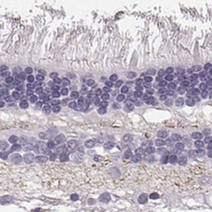 Anti-SLC1A7 antibody produced in rabbit 