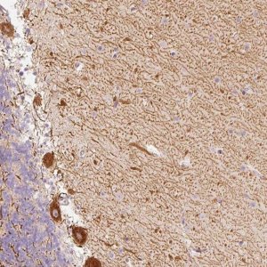 Anti-SLC20A1 antibody produced in rabbit 