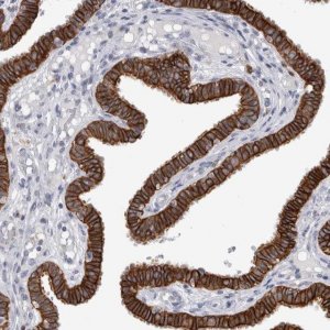 Anti-SLC20A2 antibody produced in rabbit 