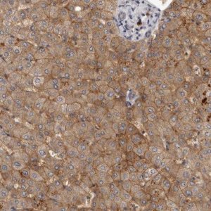 Anti-SLC22A1 antibody produced in rabbit 