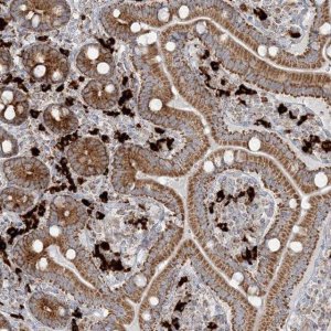 Anti-SLC22A16 antibody produced in rabbit 