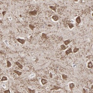 Anti-SLC22A17 antibody produced in rabbit 