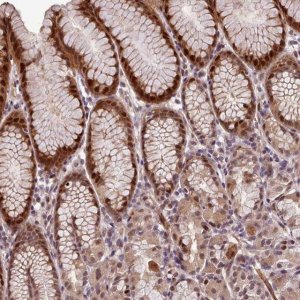 Anti-SLC22A24 antibody produced in rabbit 