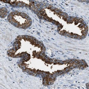 Anti-SLC25A11 antibody produced in rabbit 