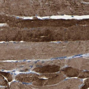 Anti-SLC25A25 antibody produced in rabbit 
