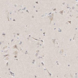Anti-SLC25A26 antibody produced in rabbit 