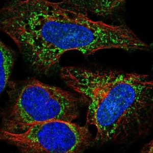 Anti-SLC25A27 antibody produced in rabbit 