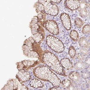 Anti-SLC25A40 antibody produced in rabbit 