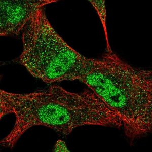 Anti-SLC25A45 antibody produced in rabbit 