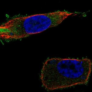 Anti-SLC27A1 antibody produced in rabbit 