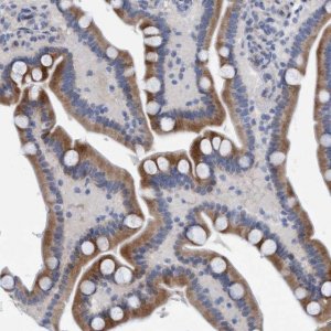 Anti-SLC28A3 antibody produced in rabbit 