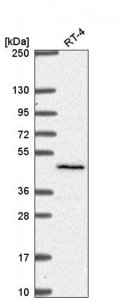 Anti-SLC29A3 antibody produced in rabbit HPA057905-100UL