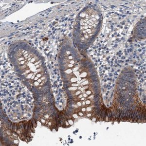 Anti-SLC2A10 antibody produced in rabbit 