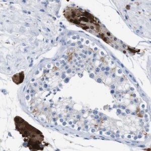 Anti-SLC2A8 antibody produced in rabbit 