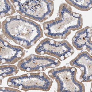 Anti-SLC31A1 antibody produced in rabbit 