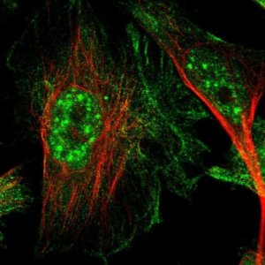 Anti-SLC31A2 antibody produced in rabbit 