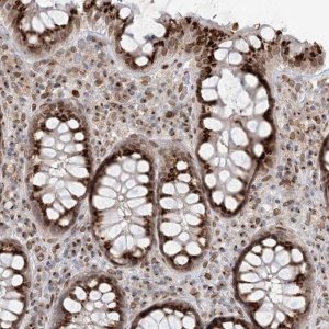 Anti-SLC35A2 antibody produced in rabbit 